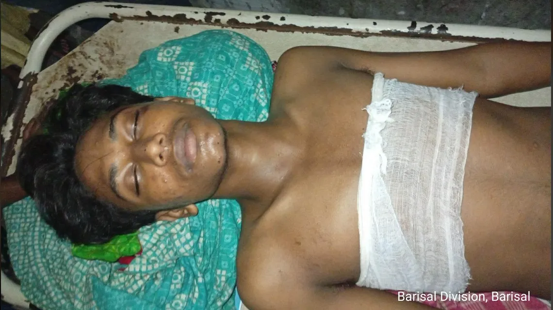 আমতলীতে ছাত্রদলের সদস্য সচিব ইমরানের নেতৃত্বে দুই কিশোরকে কুপিয়ে জখম